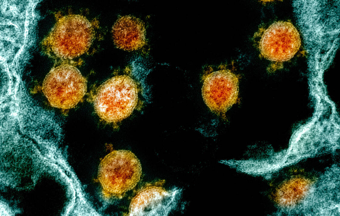 SARS-CoV-2 ist wie alle Coronaviren ein RNA-Virus. Remdesivir und Molnupiravir stören die Vermehrung des Virus an unterschiedlichen Stellen. / Foto: NIH-NIAID