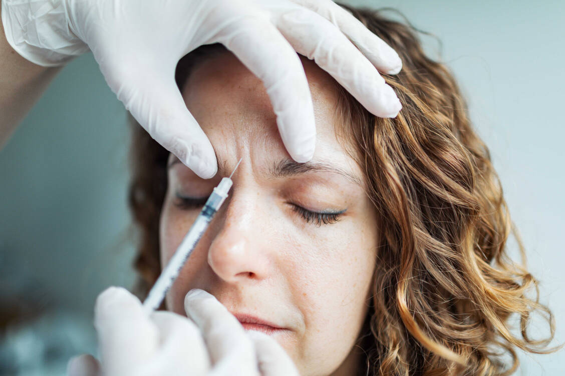 Glabellafalten ist die medizinisch korrekte Bezeichnung für die sogenannten Zornesfalten zwischen den Augenbrauen. Sie können durch Injektionen mit Botulinumtoxin geglättet werden. / © Getty Images/JulPo