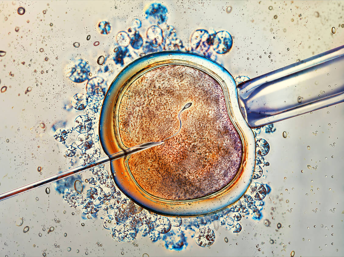 Manche Arten der assistierten Reproduktionsmedizin könnten mit einem erhöhten Krebsrisiko bei den Kindern verbunden sein. Die Hinweise sollten aber nicht überinterpretiert werden. / © Getty Images/ugurhan