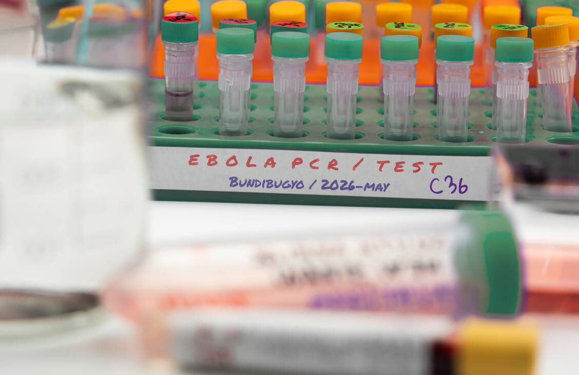 Fehlende Laborkapazitäten erschweren den Nachweis von Ebola – und steigern das Risiko an Malaria zu sterben. Besonders gefährdet: sind die Kinder. / © Getty Images/digicomphoto