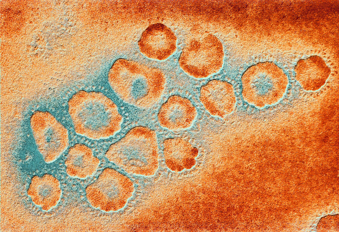 Es ist eine Sache, ob ein Arzneistoff das Coronavirus in vitro hemmt, aber eine ganz andere, ob er auch klinisch wirksam ist. / Foto: Getty Images/PASIEKA/Science Photo Library