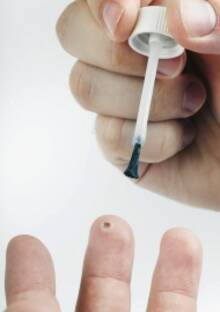 Vaseline um die Warze vor dem Aufpinseln schützt die gesunde Haut.
<p class="fotonachweis">Foto: Fotolia/leschnyhan</p>