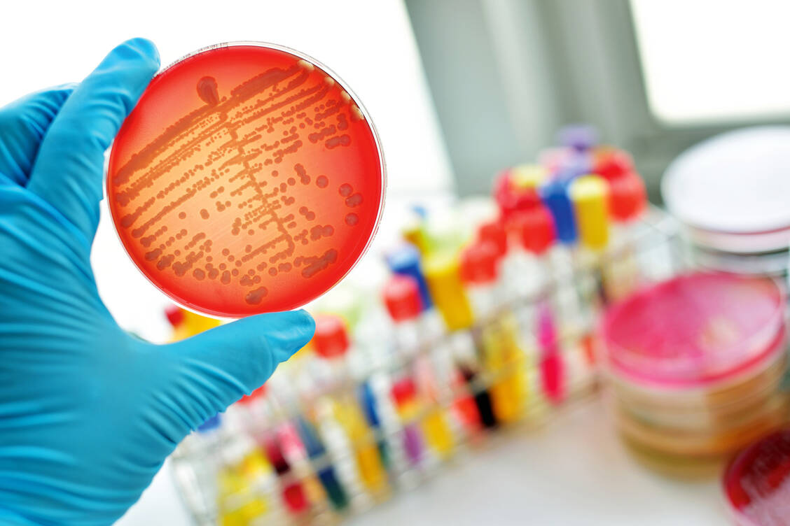 Neue Antibiotika werden dringend gebraucht, vor allem gegen gramnegative Bakterien. Lefamulin gehört zur neuen Klasse der Pleuromutiline. / Foto: Shutterstock/Jarun Ontakrai