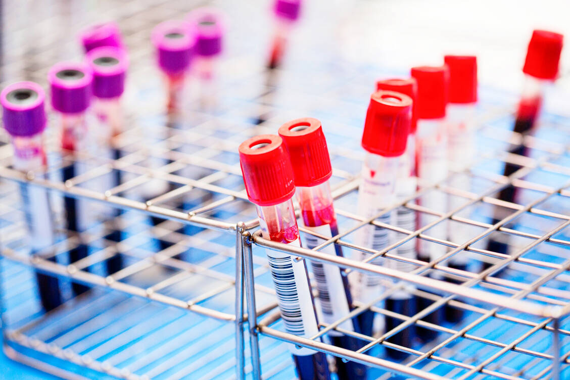 Eine akute Infektion kann einen Eisenmangel auslösen. Erholt sich der Körper davon nicht schnell wieder, sind postinfektiöse Syndrome eine mögliche Folge. / Foto: Getty Images/Srinophan69