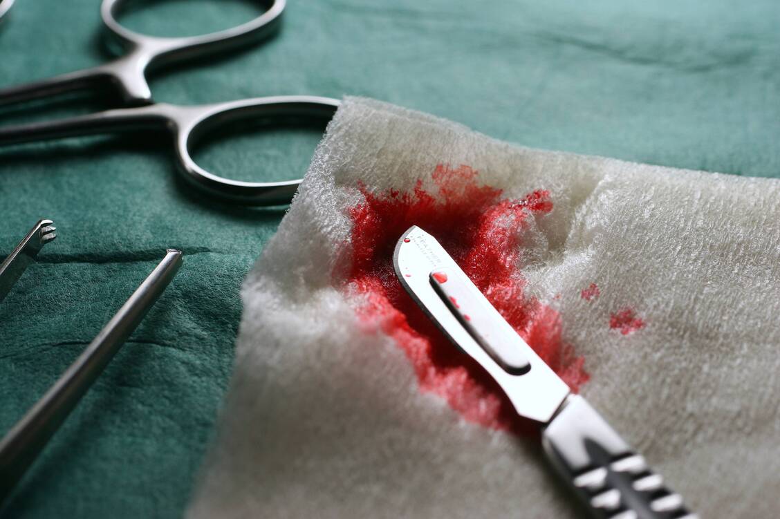 Bei Operationen müssen Patienten mit Hämophilie A Faktor-VIII-Präparate erhalten, um nicht übermäßig viel Blut zu verlieren. / Foto: Imago/Blickwinkel