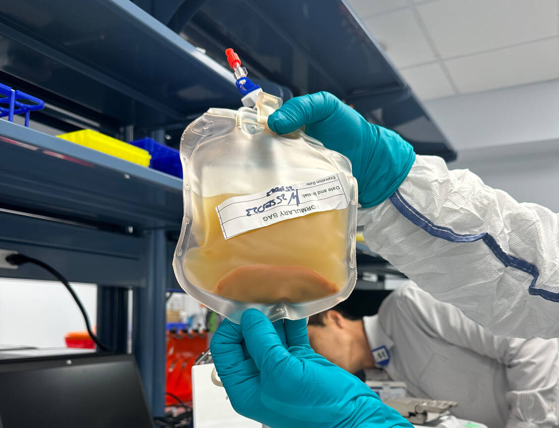 In den USA hat ein leberkranker Patient aufbereitete Leberzellen eines Spenders erhalten, die bei ihm Mini-Ersatzorgane bilden sollen. / Foto: Lygenesis