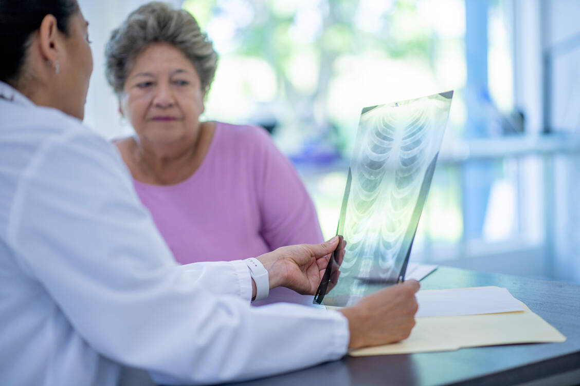 Auftreten und Symptome einer medikamentös ausgelösten Lungenerkrankung sind komplex. Anamnese und bildgebende Verfahren sind wichtige Bausteine der Diagnostik. / Foto: Getty Images/FatCamera