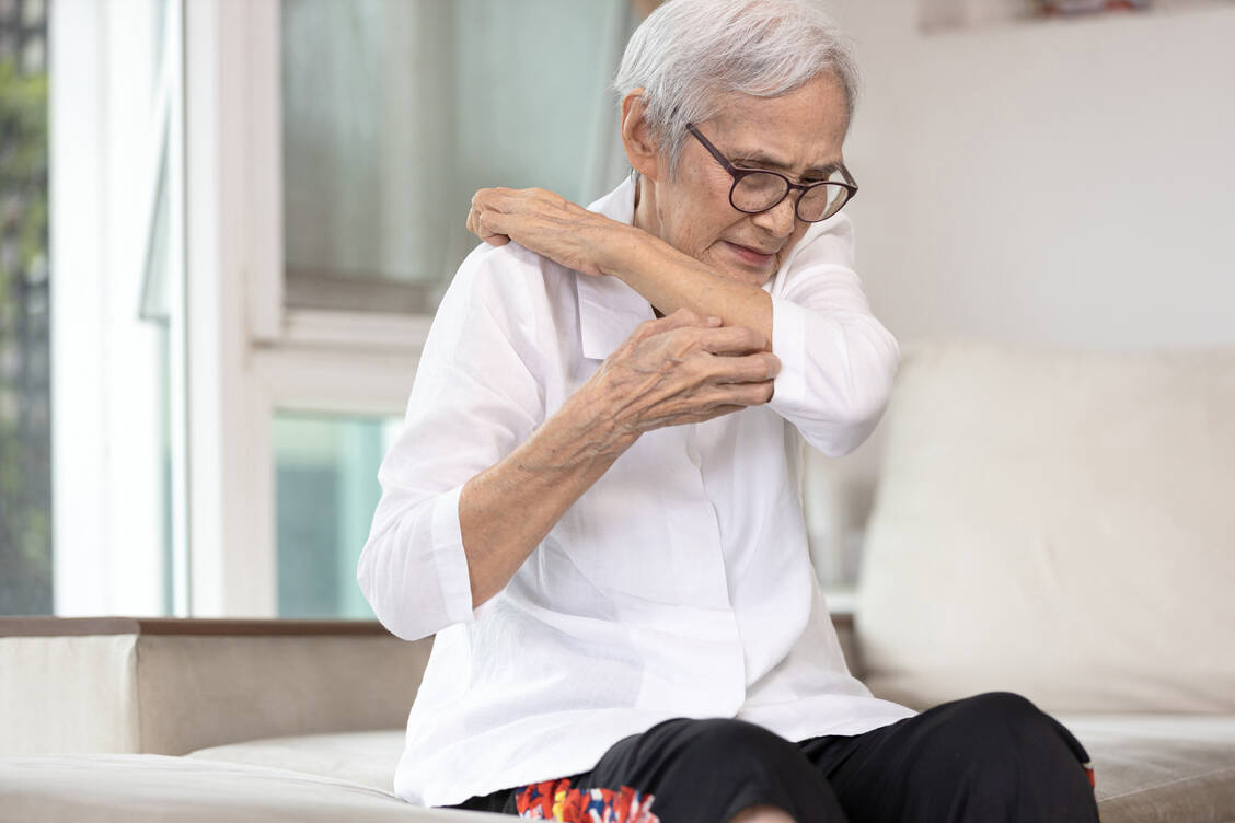 Patienten mit Prurigo nodularis leiden an einem heftigen Juckreiz, der sie zu ständigem Kratzen verleitet. Es entstehen Knoten und Papeln, die wiederum extrem jucken.  / Foto: Adobe Stock/Satjawat