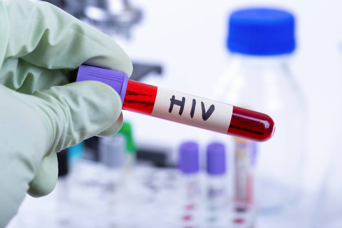 Demnächst könnte ein neuer Wirkstoff für HIV-Patienten auf den Markt kommen: der HIV-Integrasehemmer Cabotegravir. Auch als PrEP ist er im Gespräch. / Foto: Adobe Stock/Ronstik