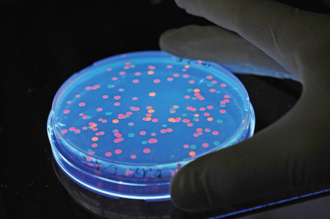 Salmonellen sind in der EU die häufigste Ursache für Krankheitsausbrüche durch Lebensmittelkeime. / Foto: picture alliance/dpa
