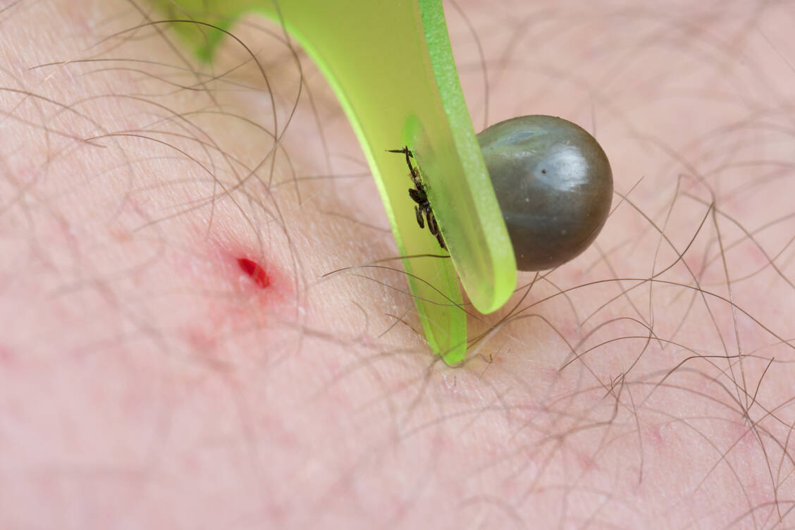 Dieses Exemplar hatte schon ausgiebig Zeit zum Blutsaugen, was das Übertragungsrisiko für Borrelien erhöht. / Foto: Adobe Stock/mirkograul