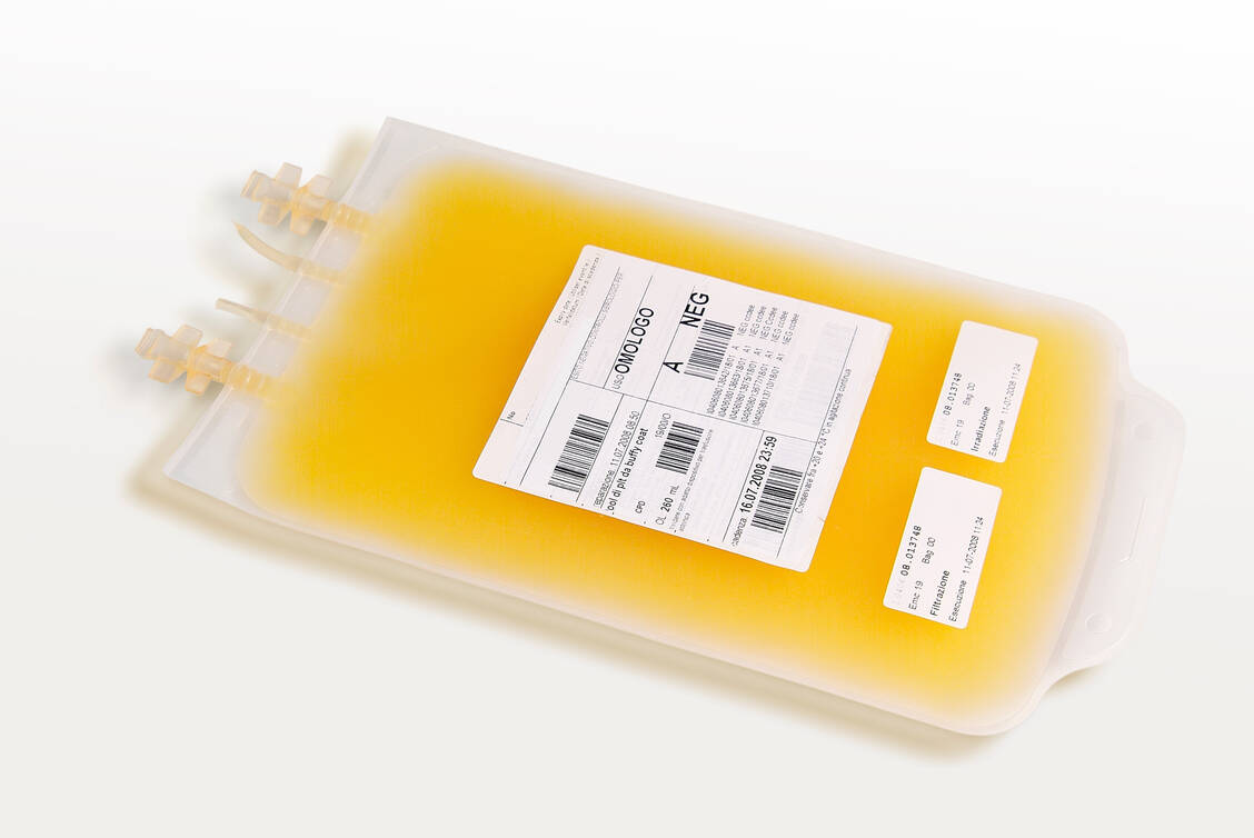 Blutplasma  ist der zellfreie Anteil des Bluts, also ohne Erythrozyten, die dem Blut die rote Farbe geben. Plasma enthält jedoch Antikörper (Symbolbild). / Foto: Getty Images/antoniotruzzi