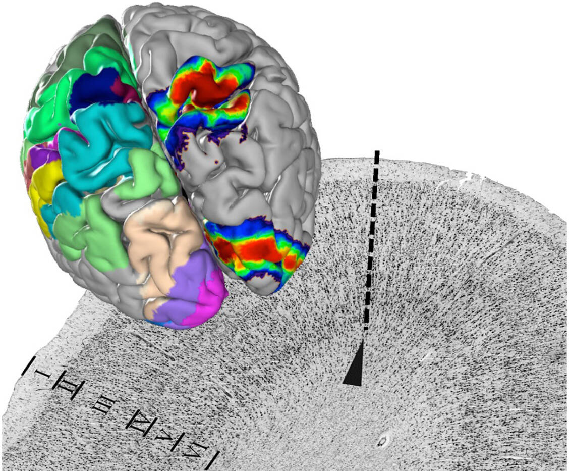 Die Architektur der Nervenzellen ändert sich an der Grenze zwischen zwei Arealen (gestrichelte Linie). Das ist die Grundlage der Kartierung. Die Areale der untersuchten Gehirne werden in den Julich-Brain-Atlas gebracht und hier überlagert. / Foto: Forschungszentrum Jülich/Katrin Amunts