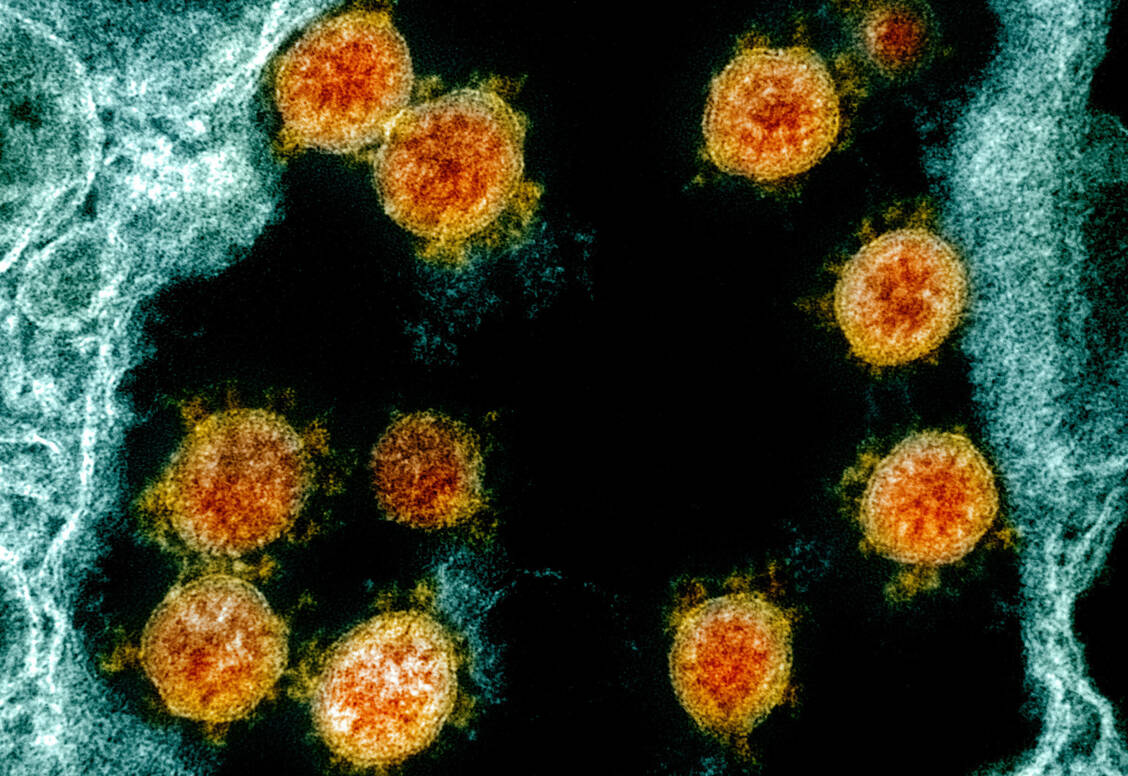 Eine bestimmte Region des Spike-Proteins von SARS-CoV-2 kann womöglich als Superantigen fungieren und Immunzellen überstimulieren. Forscher sehen darin einen Teil eines möglichen Pathomechanismus der Hepatitisfälle bei Kindern. / Foto: NIH-NIAID