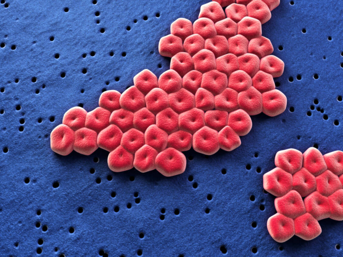 An erster Stelle der Problemkeime steht das Bakterium Acinetobacter baumannii. / Foto: Adobe Stock/ag visuell