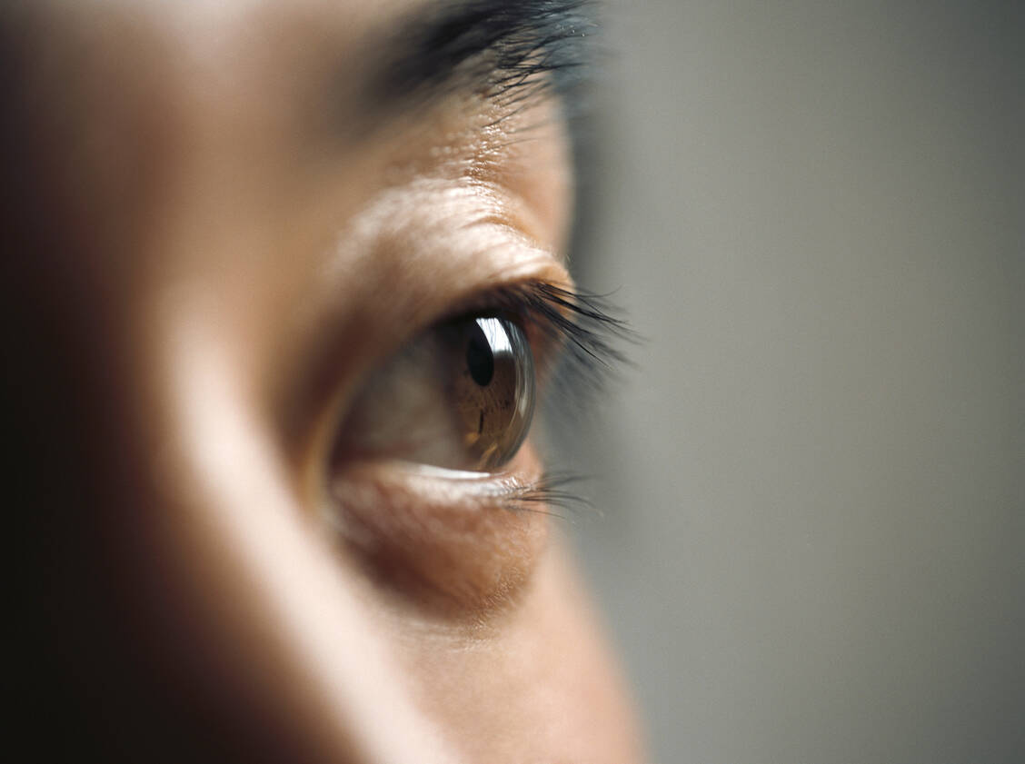 Ein typisches Symptom der Autoimmunerkrankung Morbus Basedow (Graves’ Disease) sind hervortretende Augäpfel. Dieser Exophthalmus wird als endokrine Orbitopathie bezeichnet. / © Getty Images/Veronique Beranger (Symbolbild)