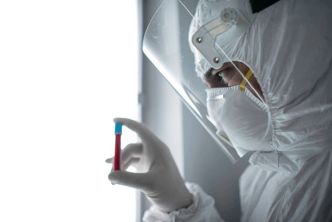 Anhand von Blutproben Geimpfter wird überprüft, wie gut eine Impfung mit Comirnaty vor Varianten des Coronavirus schützen könnte. / Foto: Getty Images/LEREXIS