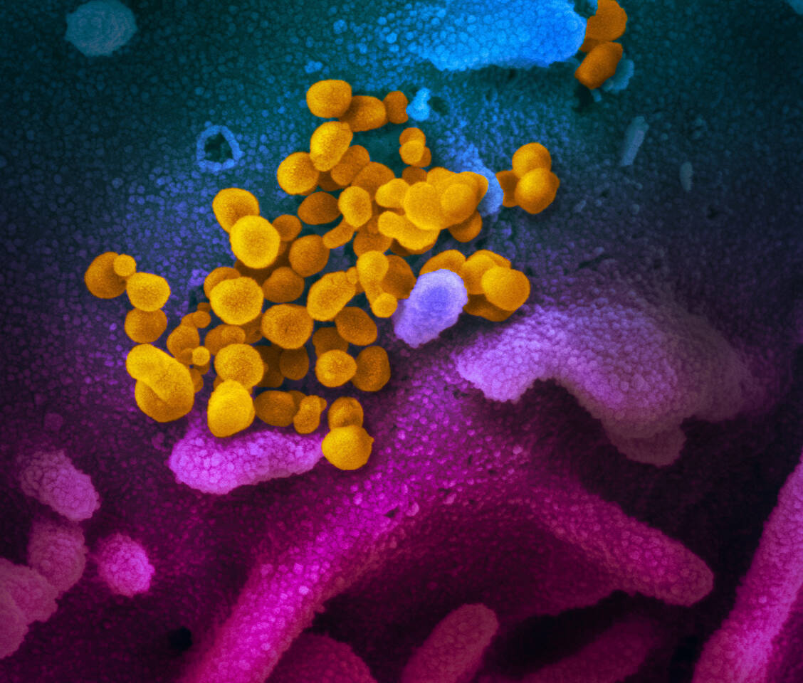 Was sich bei Grippe bewährt hat, scheint auch bei Covid-19 zu helfen: eine antivirale Kombitherapie. Zumindest bei leichten Fällen konnte in einer Studie ein Vorteil gezeigt werden. / Foto: NIH