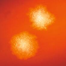 Kolonien von Clostridium difficile: Unter Antibiotikatherapie kann es zur massiven Vermehrung diese Bakteriums und zur Freisetzung darmwandschädigender Toxine kommen.
<p class="fotonachweis">Foto: CDC</p>