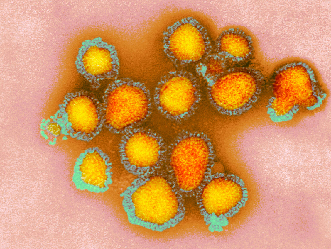 Viren des Influenza-B-Stamms Yamagata wurden seit 2020 nicht mehr nachgewiesen.  / © Getty Images/CDC/Science Photo Library