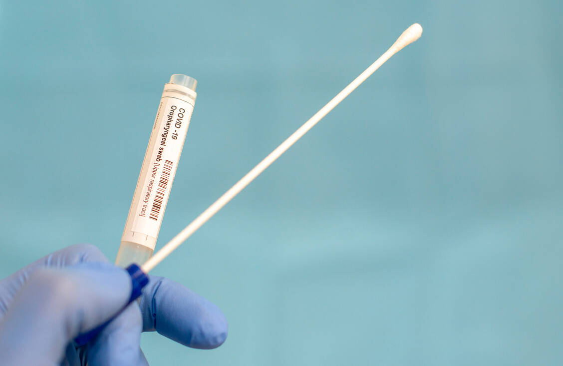 Die Zuverlässigkeit des PCR-Tests zum Nachweis einer SARS-CoV-2-Infektion hängt auch von der Güte der Probengewinnung ab. / Foto: Getty Images/Paul Biris