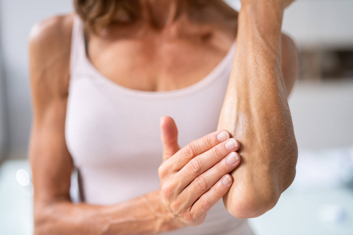 Eine transdermale Anwendung von Hormonen in den Wechseljahren entspricht eher den physiologischen Verhältnissen im Körper als die orale Gabe – und ist mit weniger Risiken verbunden.  / © Getty Images/Andrey Popov