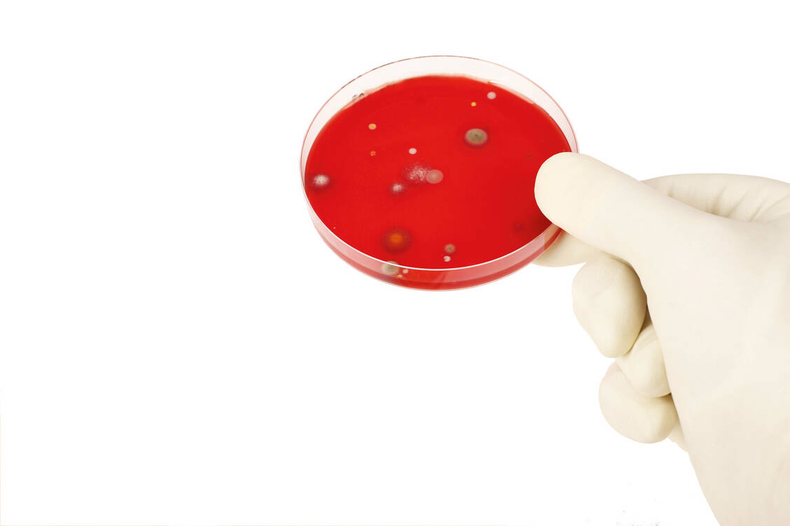 Im Gegensatz zu Clopidogrel konnte Ticagrelor einige multiresistente Bakterien in In-vitro-Tests hemmen. / Foto: Fotolia/dondoc-foto