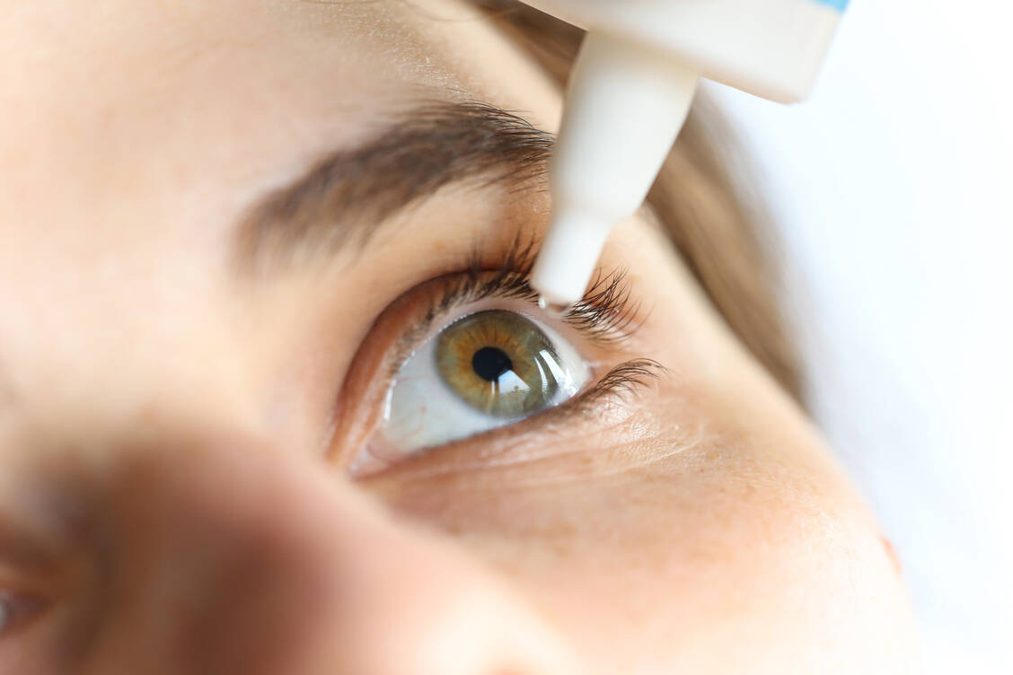 Augentropfen werden sehr häufig abgegeben, die Beratung ist aber nicht trivial. / © Adobe Stock/Katarina