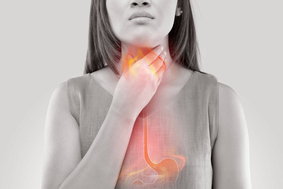 Sodbrennen ist ein typisches Symptom der Refluxkrankheit. / Foto: Adobe Stock/Adiano