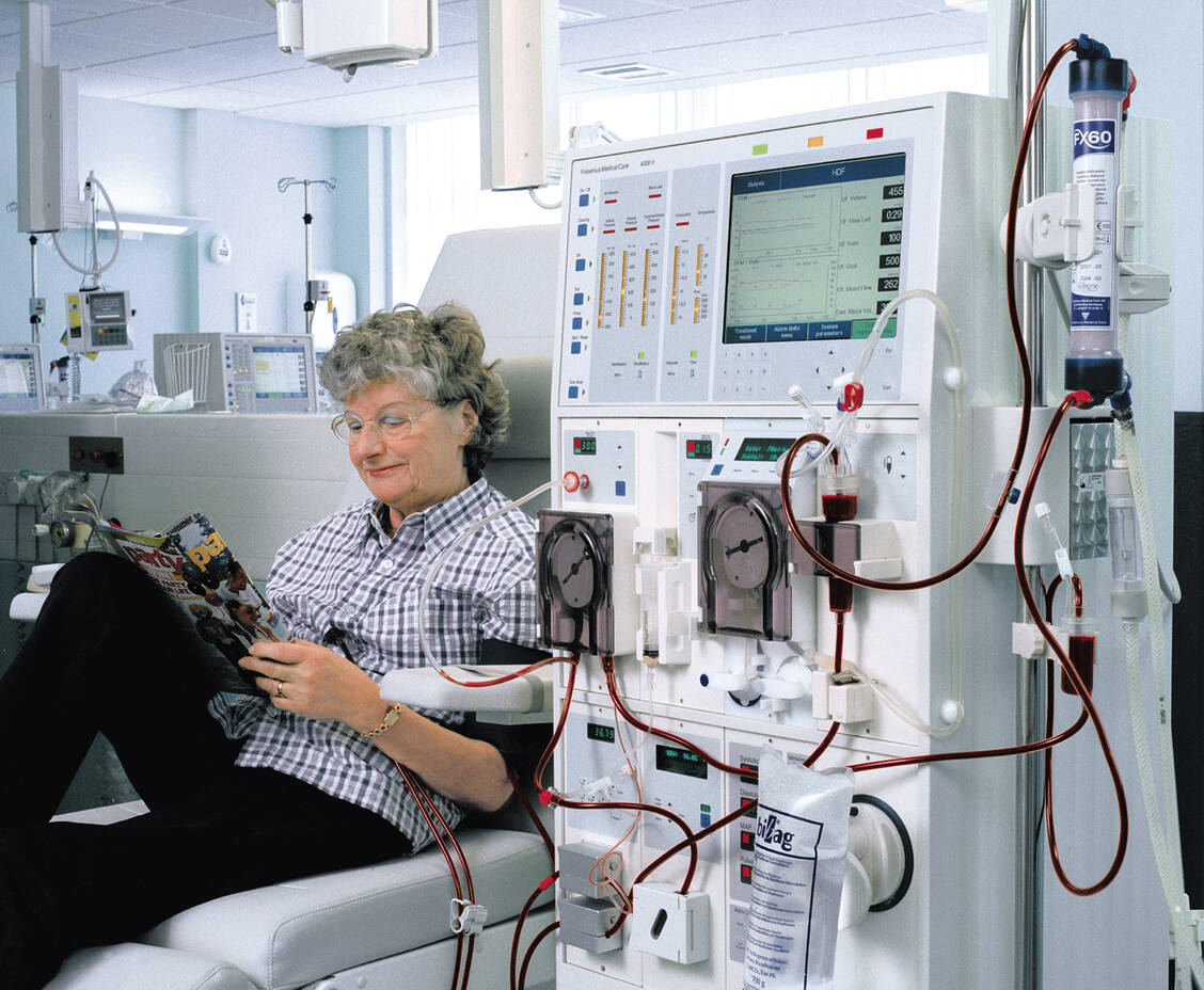 In Deutschland  sind etwa  80 000 Menschen abhängig von  der Dialyse.  Foto: BVMed