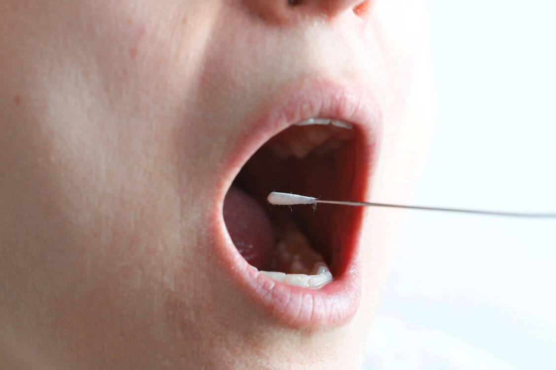 Die korrekte Probenentnahme ist ausschlaggebend für die Zuverlässigkeit von SARS-CoV-2-Schnelltests. / Foto: Imago/STPP