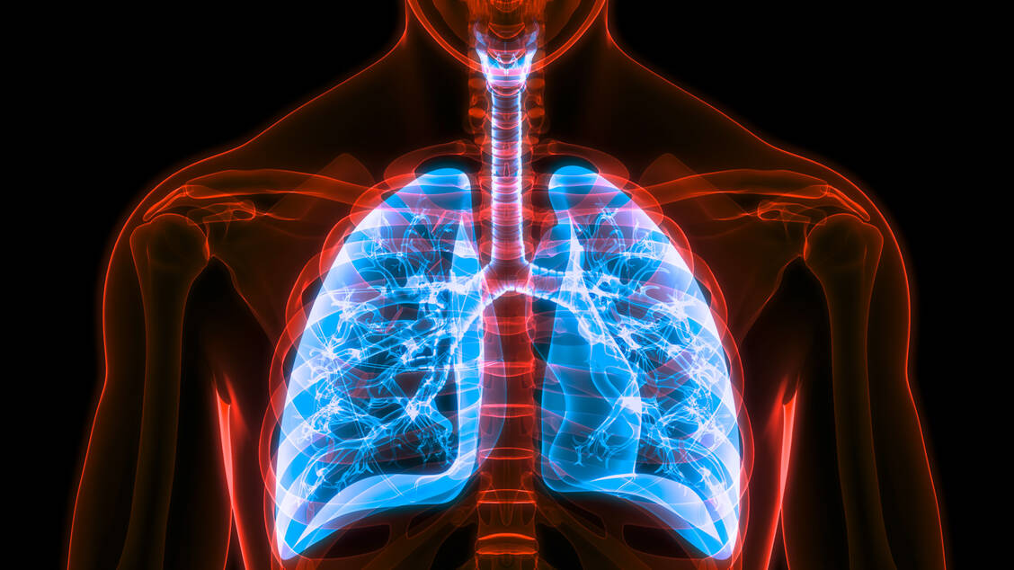 Wenn Covid-19-Patienten auf eine externe Sauerstoffzufuhr angewiesen sind, ist ihre Lunge bereits stark geschädigt. In dieser Situation könnten sie von Baricitinib profitieren. / Foto: Adobe Stock/magicmine
