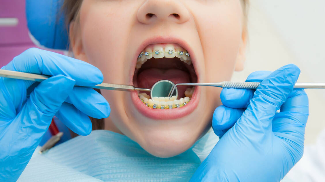 Gerade Zähne gibt es manchmal nur mithilfe von Zahnspangen oder anderen kieferorthopädischen Behandlungen. Aber machen sie auch medizinisch einen Sinn? Foto: Fotolia/Dmitry