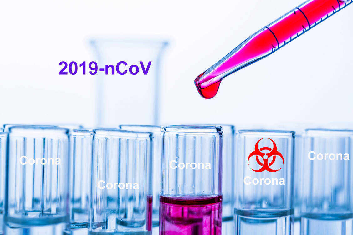 Mit einem geprüften Impfstoff gegen das neue Coronavirus ist Experten zufolge frühestens in einem Jahr zu rechnen. / Foto: Imago/blickwinkel