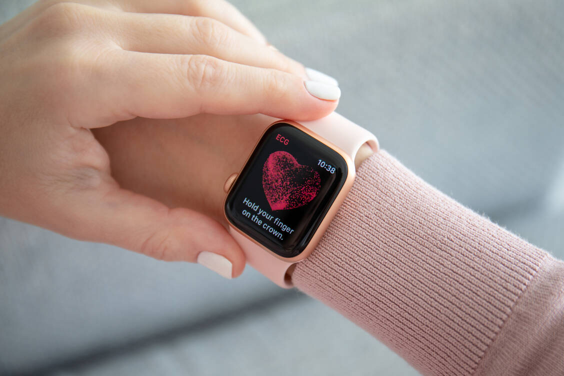 Smartwatches können den Träger zum Beispiel bei unregelmäßigem Herzschlag warnen. Die hohe Fehlalarmquote kostet das Gesundheitssystem jedoch eine Menge Geld, vermuten OECD-Experten. / Foto: Adobe Stock/Denys Prykhodov