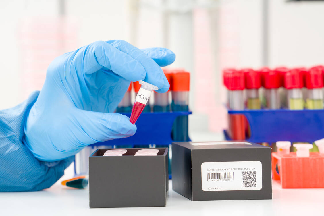 Zu ungenau sind Antikörpertests für SARS-CoV-2 noch. Das ist das Ergebnis von gleich zwei großen Literaturauswertungen. / Foto: Adobe Stock/wladimir bulgar