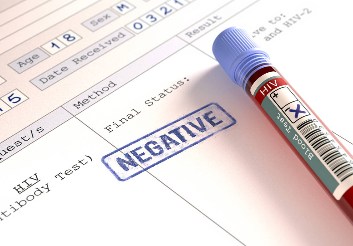 Die übliche Testmethode war in einer PrEP-Studie mit Cabotegravir offenbar zu wenig sensibel, um HIV-Infektionen früh nachzuweisen. / Foto: Adobe Stock/ktsdesign