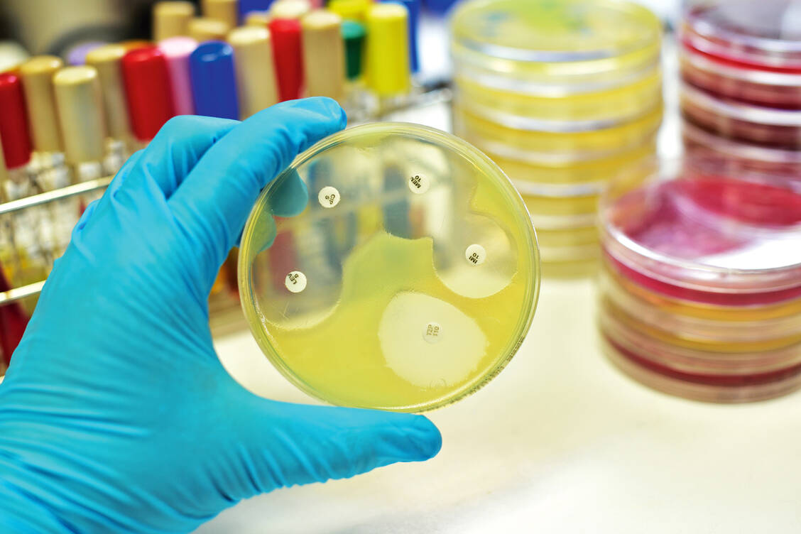 Kampf gegen Resistenzen: Nach Angaben von IQVIA befinden sich derzeit weltweit 226 Antibiotika-Präparate in der Pipeline. / Foto: Shutterstock/Jarun Ontakrai