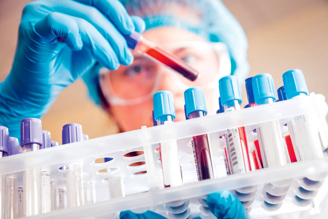 Der Titer von neutralisierenden Antikörpern gegen SARS-CoV-2 gibt an, wie gut man gegen eine Infektion geschützt ist. / Foto: Shutterstock/Romaset