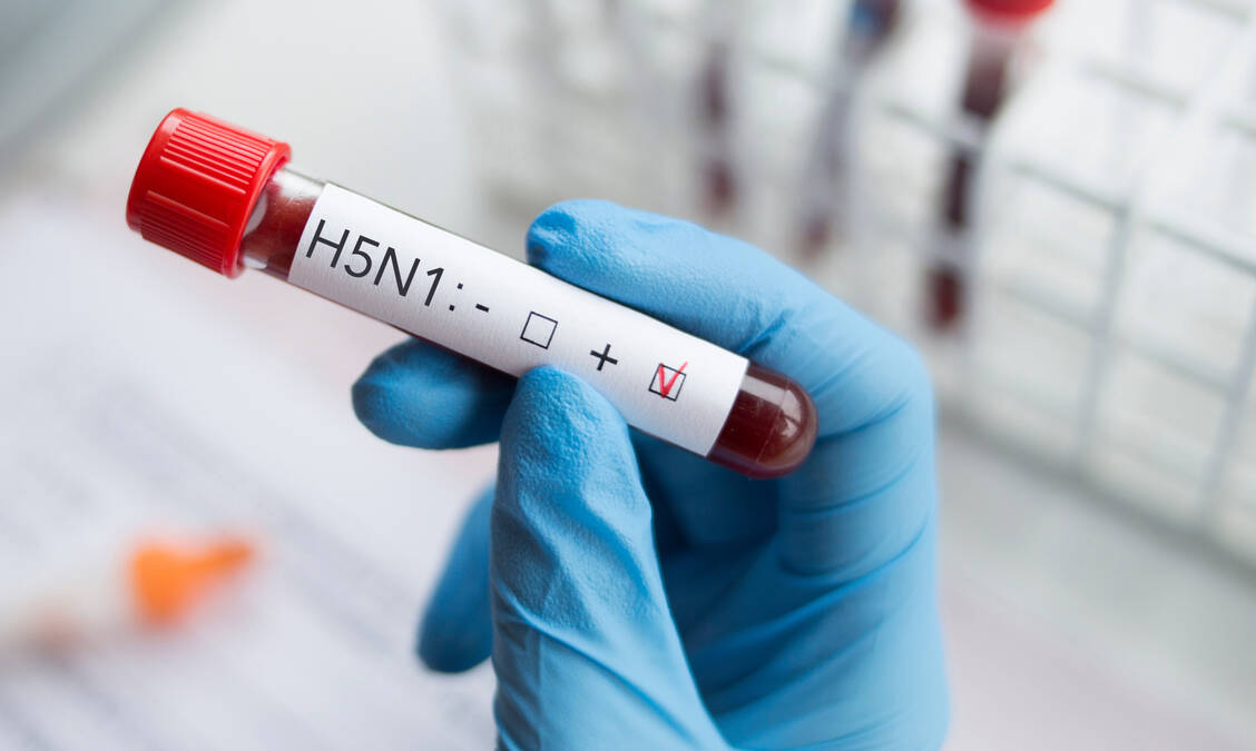 Bisher haben sich in den USA nachweislich drei Menschen mit dem H5N1-Virus infiziert. Experten gehen von einer weitaus höheren Dunkelziffer aus und mahnen zur Vorsicht. / Foto: Adobe Stock/forma82