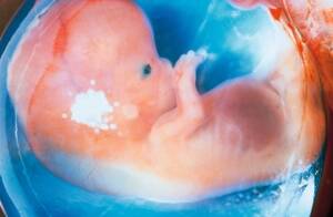 Sehr gute Überlebenschancen: Die meisten angeborenen Herzfehler werden bereits im Mutterleib diagnostiziert.