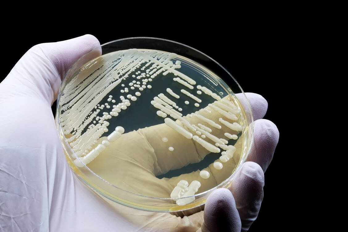 Mediziner und Mikrobiologen fordern eine umfassendere Testung und eine Meldepflicht für Candida-auris-Infektionen. / Foto: Adobe Stock/TopMicrobialStock