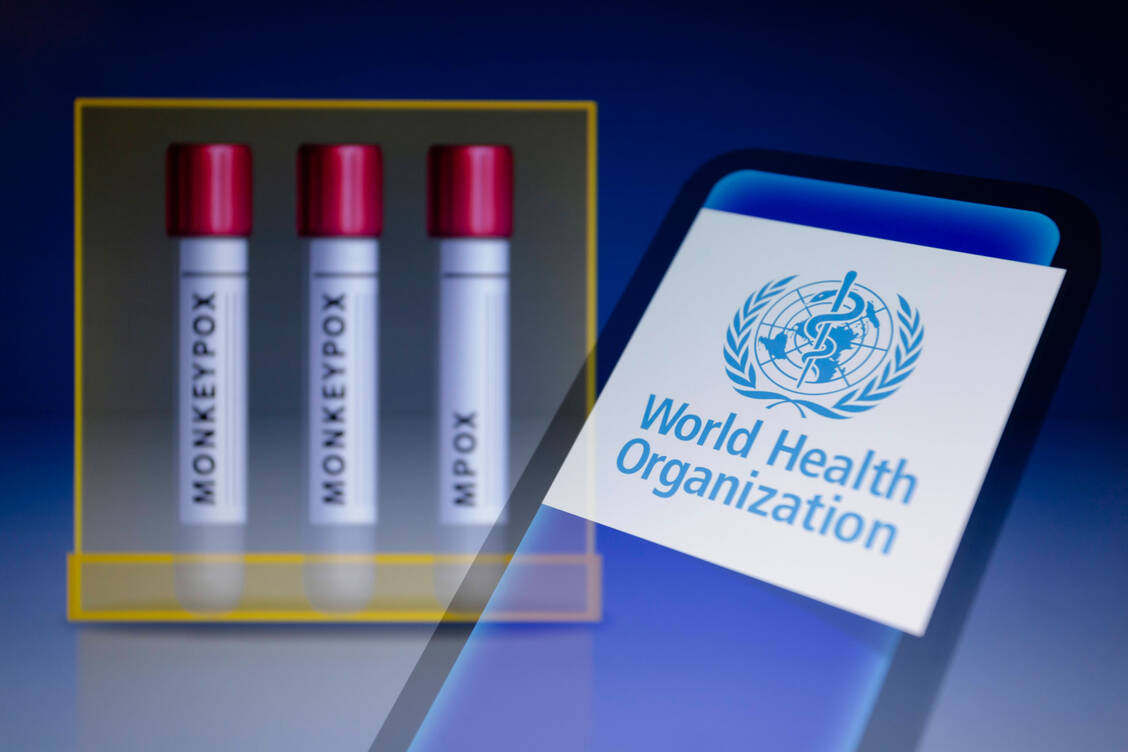 Die Weltgesundheitsorganisation (WHO) hat angesichts steigender Mpox-Fallzahlen in Afrika und einer neuen Virusvariante eine gesundheitliche Notlage internationaler Tragweite ausgerufen. / Foto: Imago Images/Zuma Press Wire