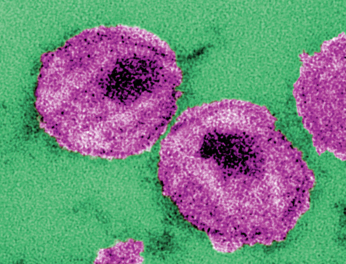 Wird das HI-Virus daran gehindet, sich an seine Zielzelle anzuheften, kann es sich nicht mehr vermehren. Fostemsavir ist der erste sogenannte Attachment-Inhibitor. / Foto: CDC