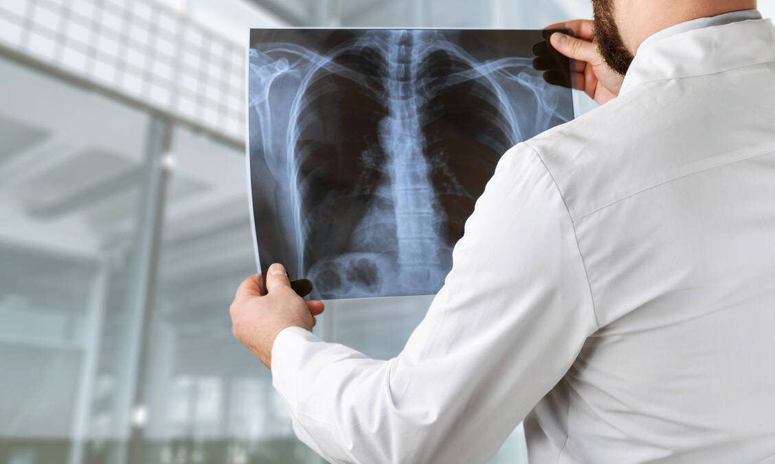 Häufig liefert die Diagnostik bei Verdacht auf eine invasive Mykose keinen eindeutigen Befund, ein unmittelbarer Therapiestart ist für eine erfolgreiche Behandlung jedoch unverzichtbar. / Foto: Adobe Stock/BillionPhotos.com