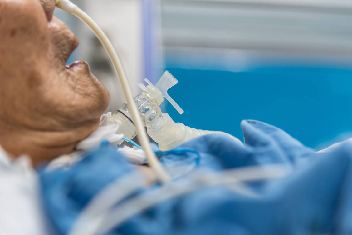 Erkranken künstlich beatmete Patienten an einer Lungenentzündung, sind häufig multiresistente Keime im Spiel. / Foto: Adobe Stock/Vasuta