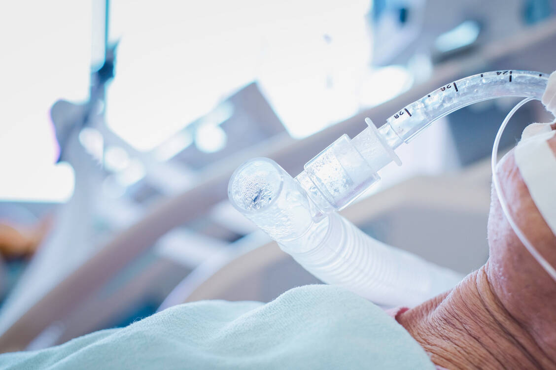 Müssen Covid-19-Patienten beatmet werden, haben sie eine schlechte Prognose. In den USA werden jetzt Remdesivir und Aviptadil bei diesen Patienten getestet. / Foto: Getty Images/Taechit Taechamanodom