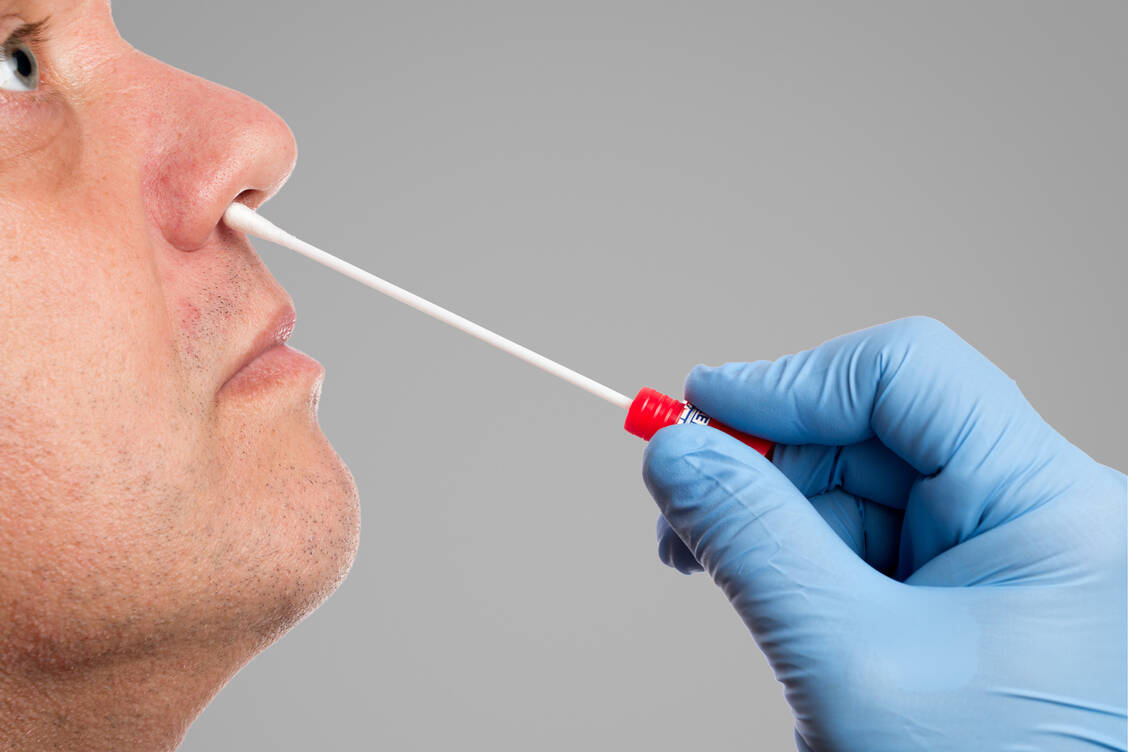 Für den neuen Test wird Material aus Rachen- oder Nasen-Rachen-Abstrichproben verwendet. / Foto: Adobe Stock/Henrik Dolle