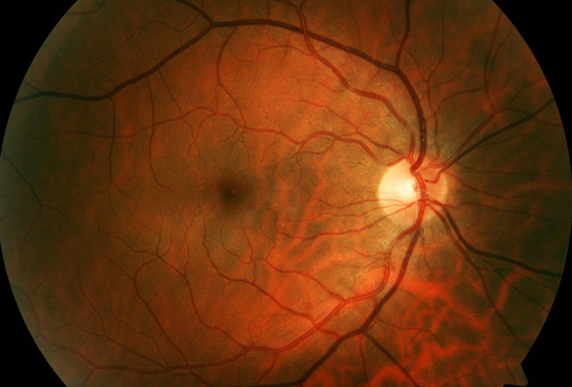 Mithilfe der Fundusfotografie lassen sich die Blutgefäße in der Netzhaut erkennen. / © Getty Images/Edward Shaw