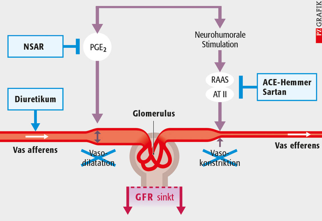 Abbildung 2: Einfluss von RAAS-Blockern und NSAR auf die glomeruläre Filtrationsrate der Nieren; Erläuterung im Text / Foto: Stephan Spitzer